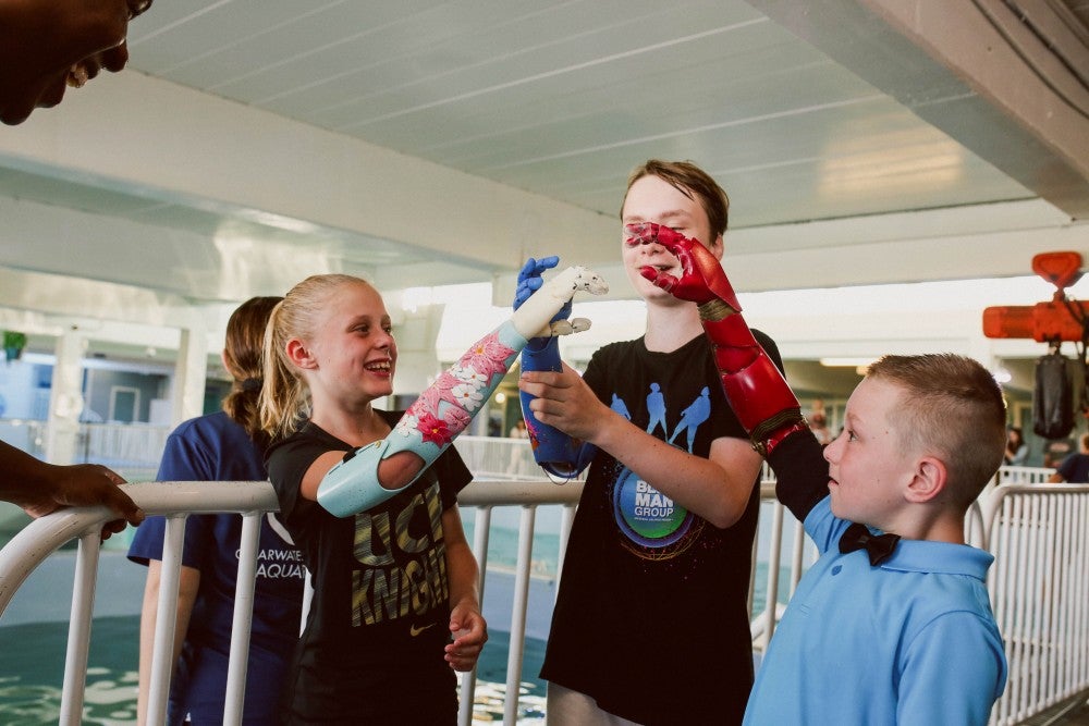 three children high-fiving with bionic arms