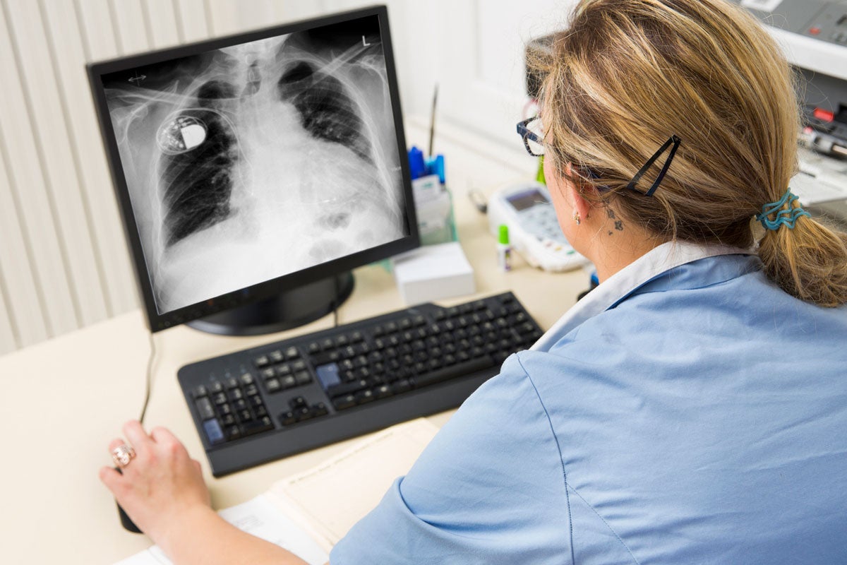 A blonde woman wearing a blue shirt sits at a desk and looks at a computer screen with an x ray of lungs on the screen
