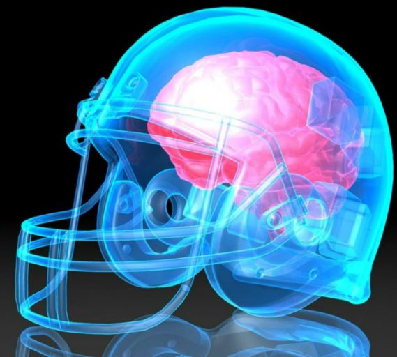 concussion-brain-football-helmet