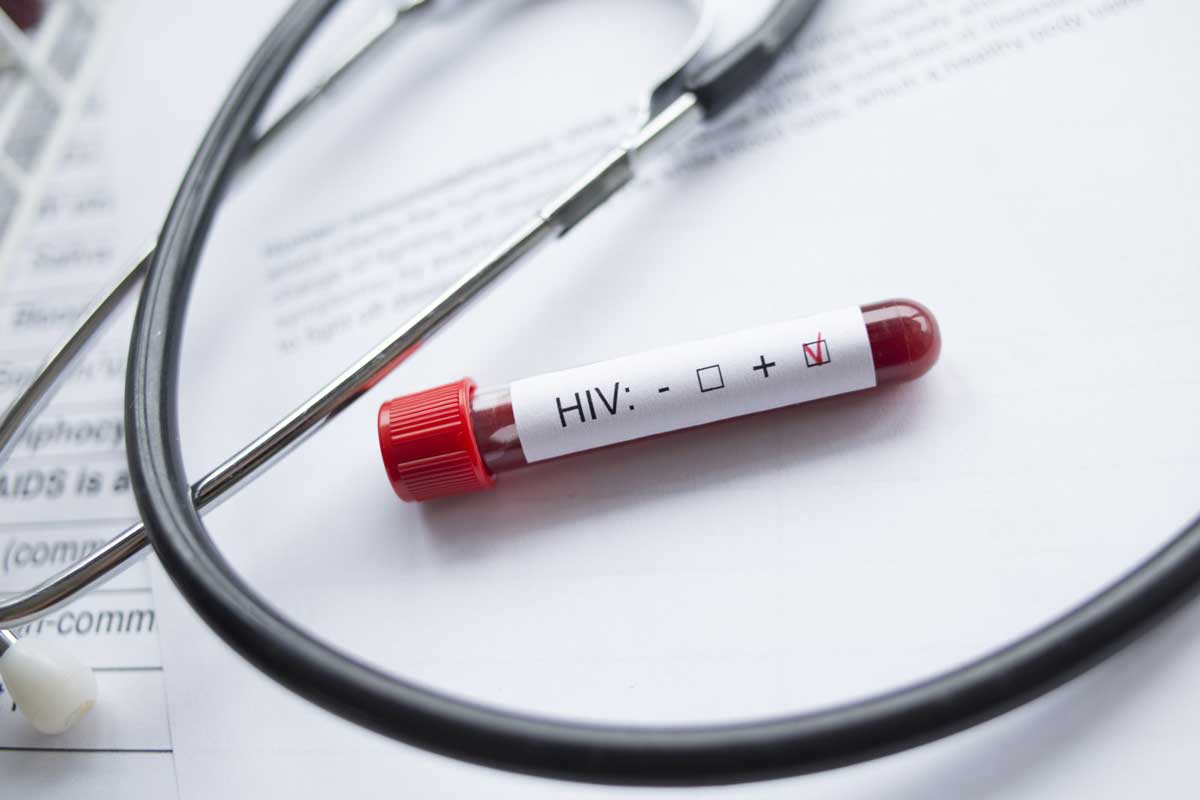 Close up of stethoscope and HIV test.