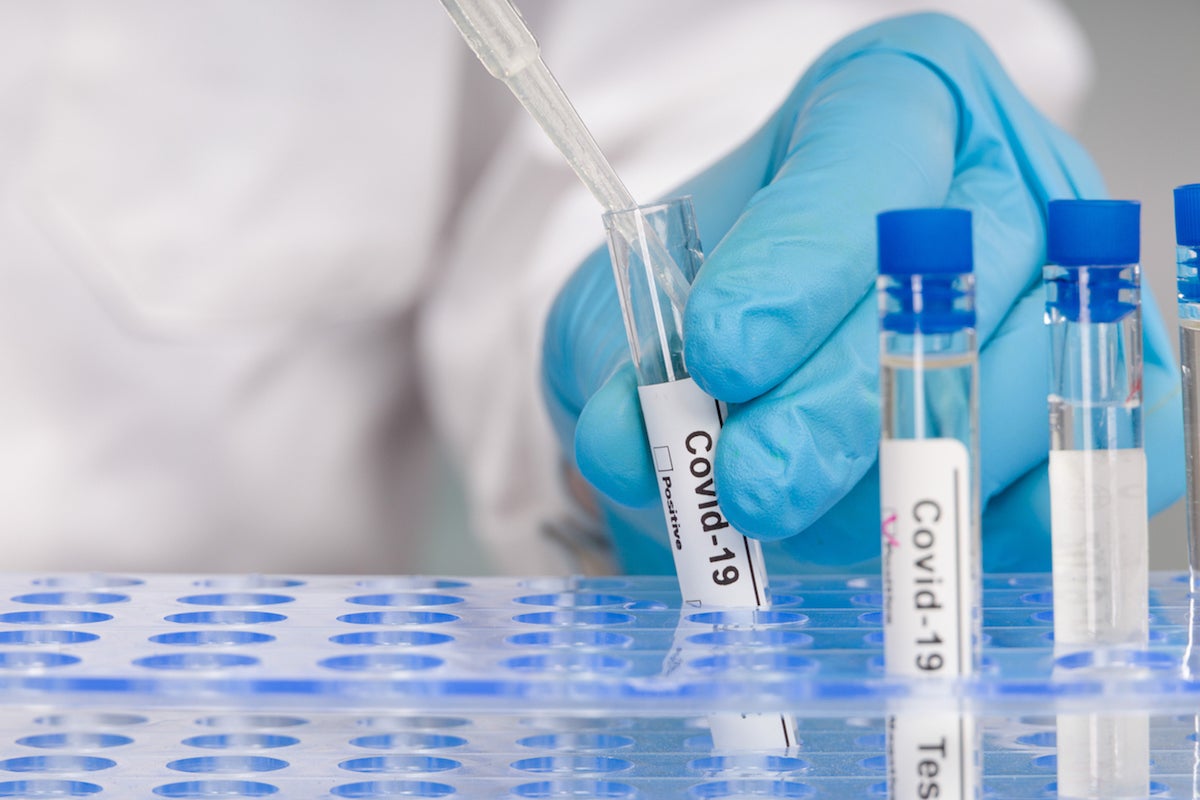 Doctor's hand with medical glove and a test tube