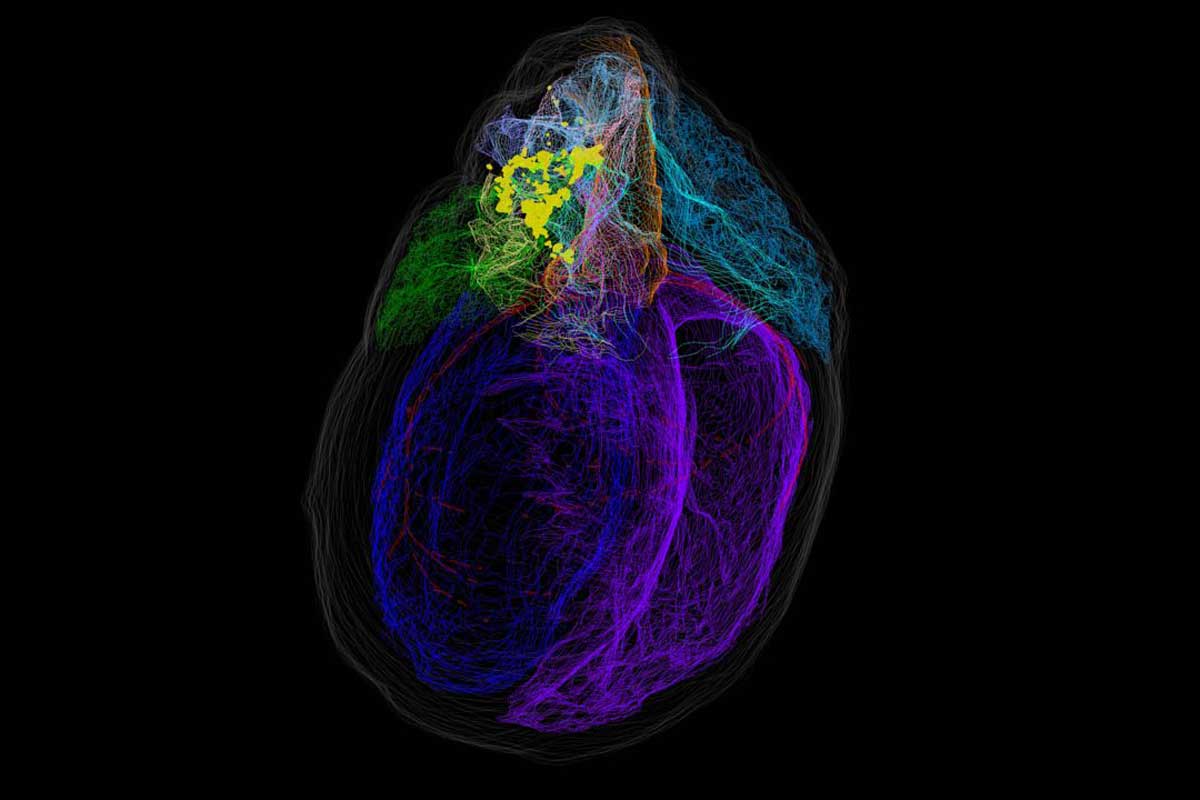3D view of mapped heart