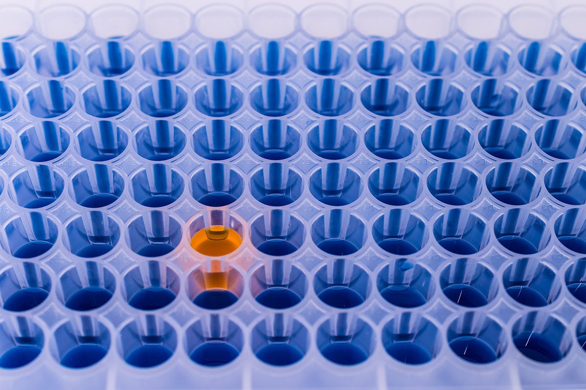 enzyme-linked immunosorbent assay also known as ELISA
