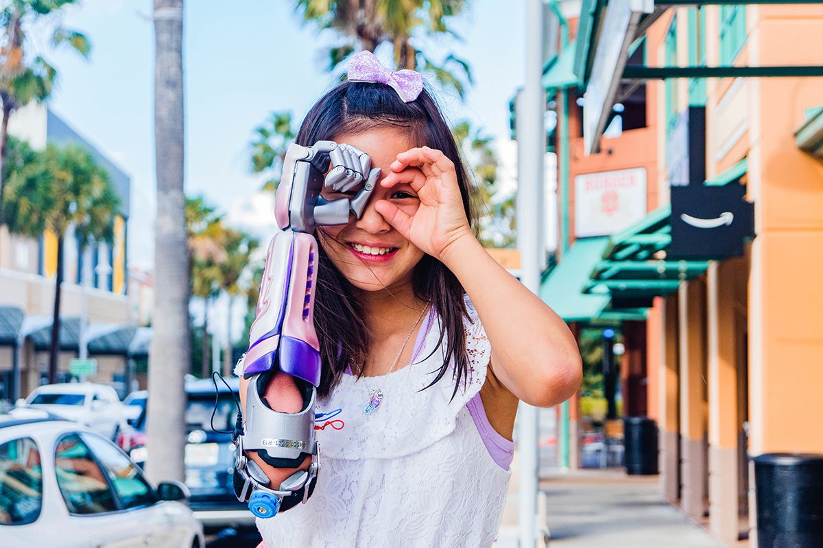 child with bionic arm