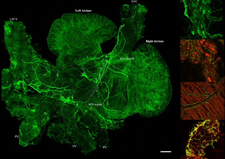 UCF Researchers Create Digital Map of Sympathetic Nervous System ...