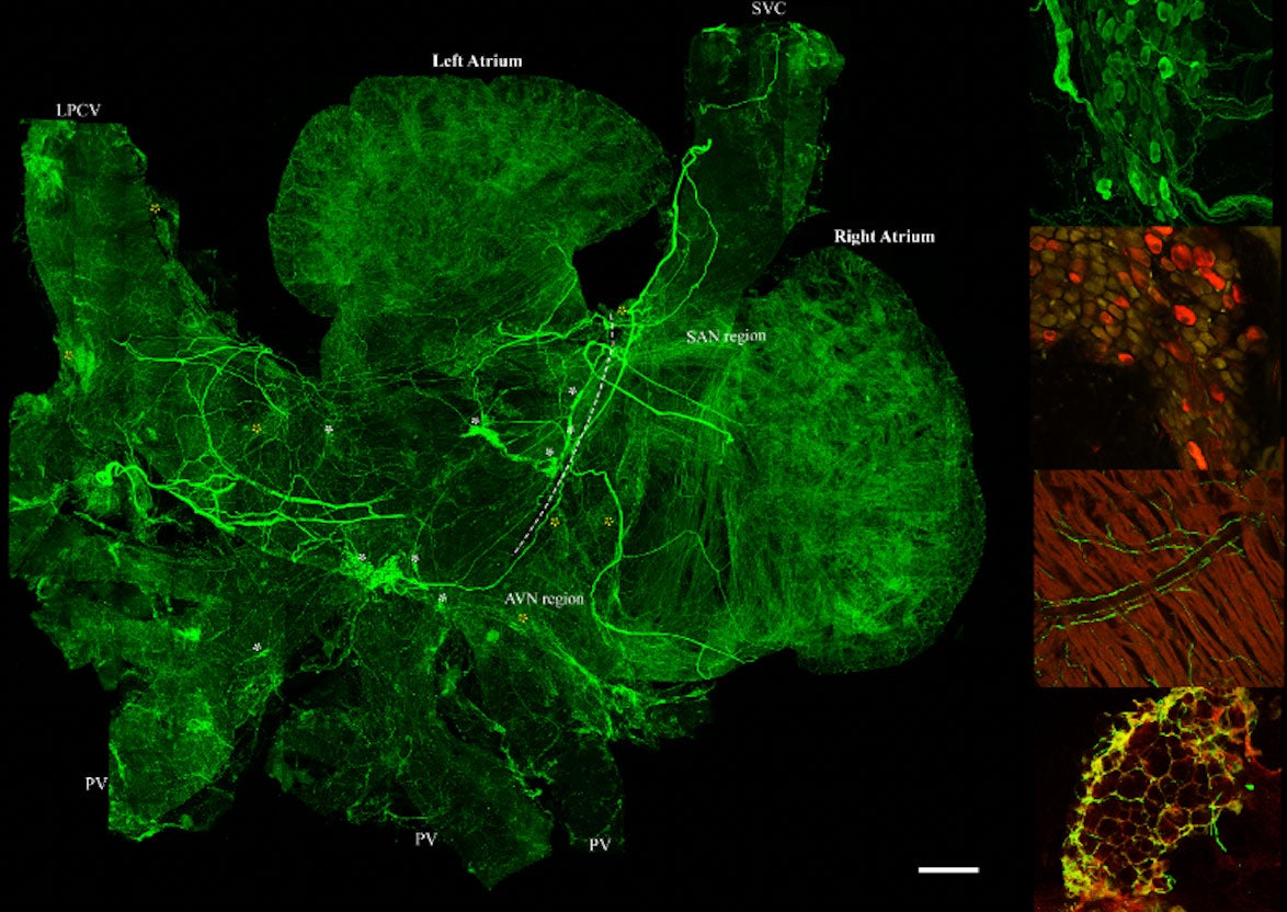 A microscopic map of the heart