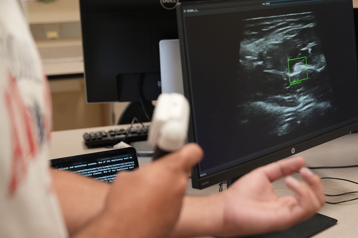 A closeup of an individual focusing a handheld, white prope on their arm while ultrasound imaging appears on a computer monitor behind them.