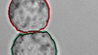 Medical Image Processing Medical Image Processing